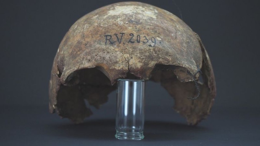 Cientistas identificam possível ‘paciente zero’ da peste bubônica, morto há 5 mil anos