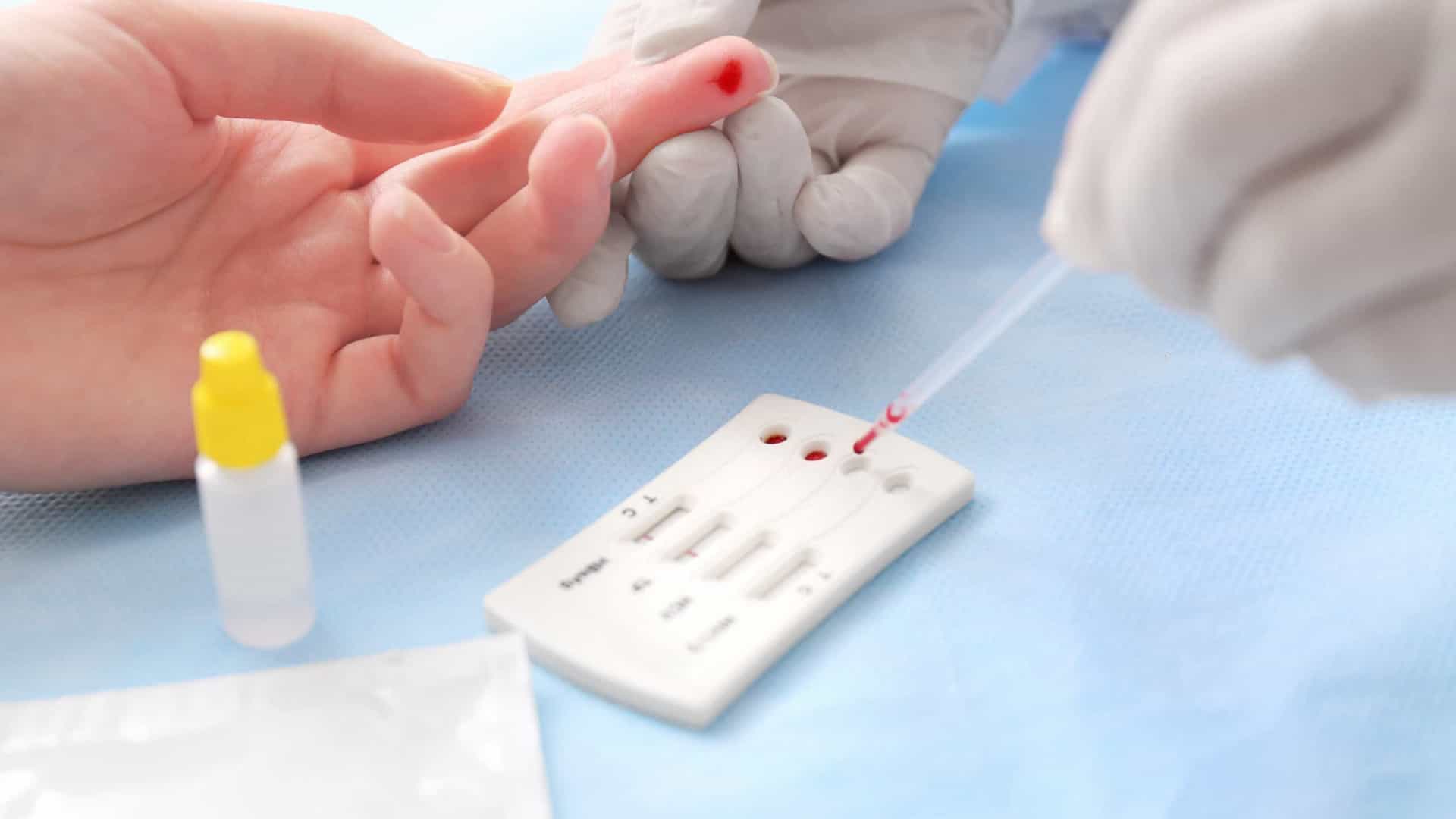 Cientistas testam vacina contra HIV